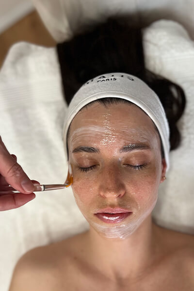 Corrective Peel Solution, hámlasztó kezelés 30 éves kortól, budapest 11. kerület, bőrfeszesítés, matis, anti-ageing